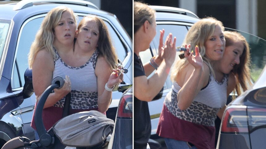 conjoined twins abby and brittany hensel address blessed newborn baby pics 68b786d9a529f