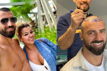 andrei stoica celebrul luptator de kickboxing isi face implant de par am simtit nevoia de un refresh acum e momentul potrivit 6904695f2b5fd