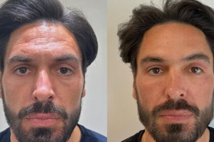 how mario falcone became the hottest dad at the school gates former towie star 37 is maintaining his youth with dermal fillers salmon sperm facials and chemical peels 68f4f528f38ff