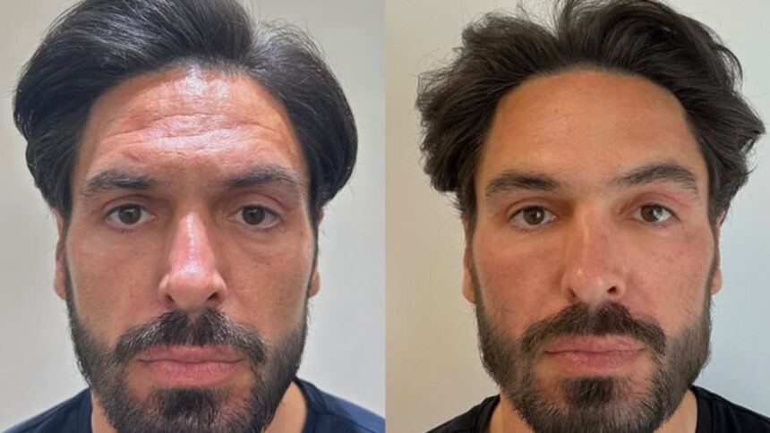 how mario falcone became the hottest dad at the school gates former towie star 37 is maintaining his youth with dermal fillers salmon sperm facials and chemical peels 68f4f528f38ff