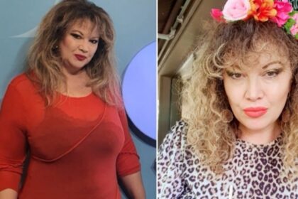 semnul divin care i a aparut pe piele oanei lis sotia lui viorel a intampinat probleme de sanatate a ramas ca o cruce 69396251b0f47