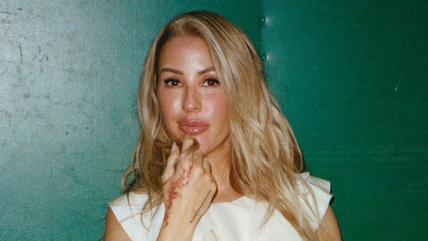 ellie goulding reveals she couldnt leave the house due to crippling panic attacks as she struggled with her sudden rise to fame 697a6eb92c822