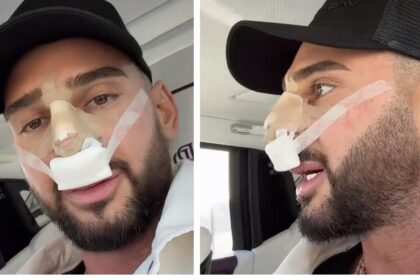 problema grava pentru dorian popa ce a patit vedeta imi cadea nasul de tot ca la michael jackson 696918a923a94